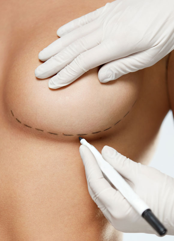 Northwood Hospital - Breast augmentation The Procedure