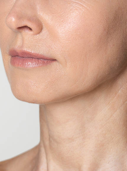 Northwood Hospital - Don’t like my wrinkles