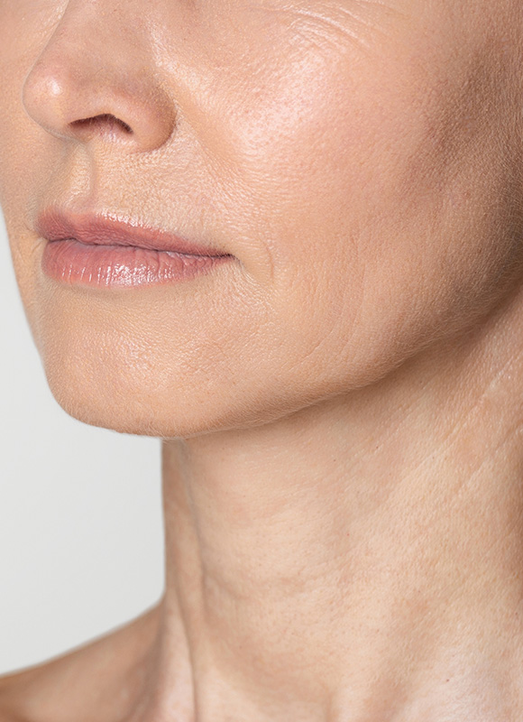 Northwood Hospital - Don’t like my wrinkles