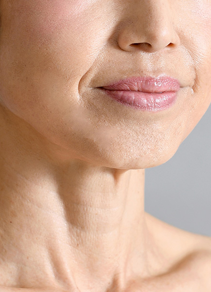 Northwood Hospital - Don’t like my wrinkles