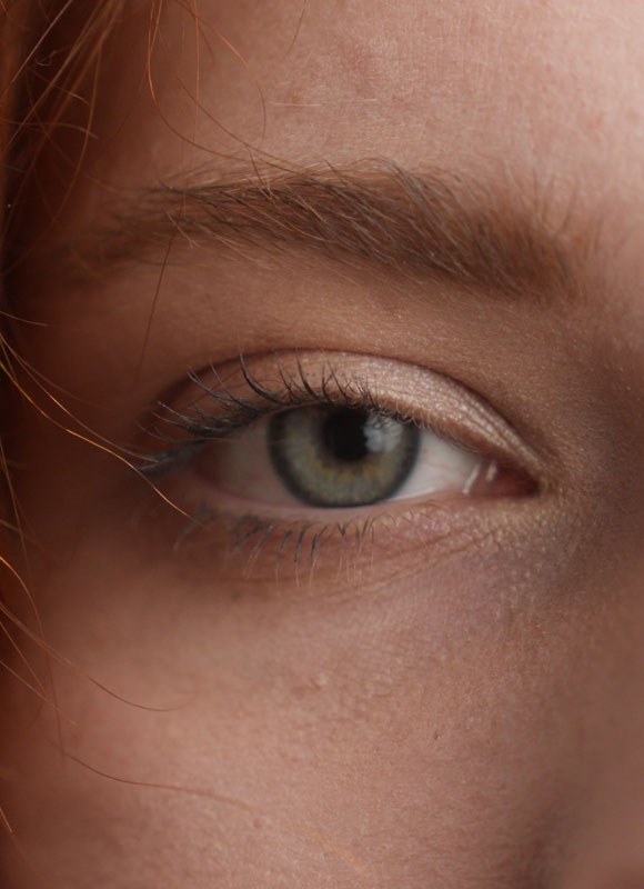 Northwood Hospital - Eyelid surgery The Procedure