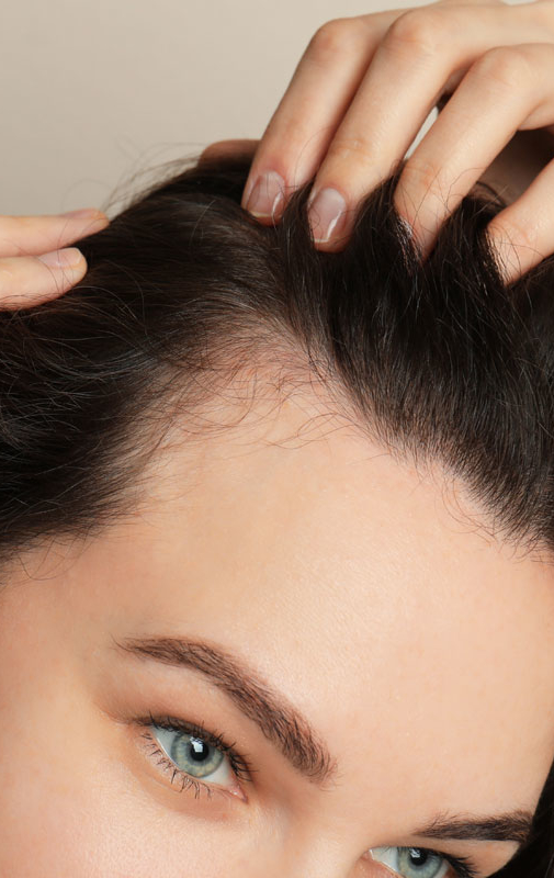 Northwood Hospital - Hairline Lowering Procedure Overview