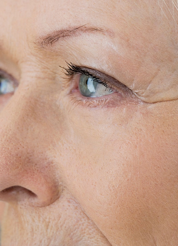 Northwood Hospital - I don’t like my wrinkles