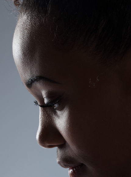 Northwood Hospital - I have a high forehead