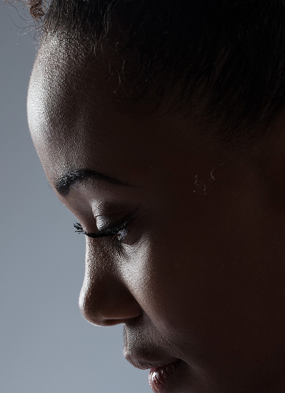 Northwood Hospital - I have a high forehead