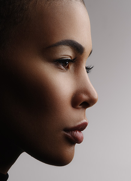 Northwood Hospital - I have a high forehead