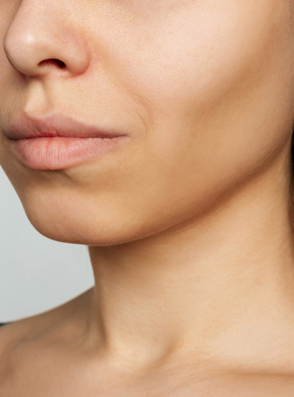 Northwood Hospital - I have lost facial definition