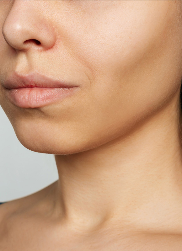 Northwood Hospital - I have lost facial definition