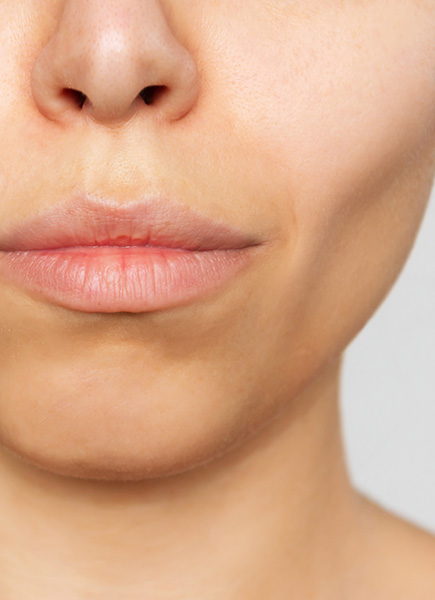 Northwood Hospital - I have lost facial definition