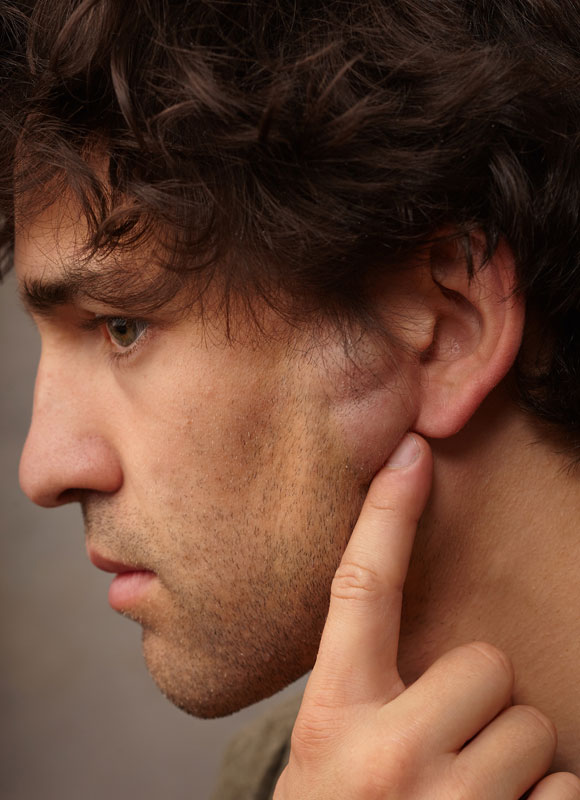 Northwood Hospital - Lipomas Procedure Overview