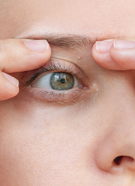 Northwood Hospital - Low Brow