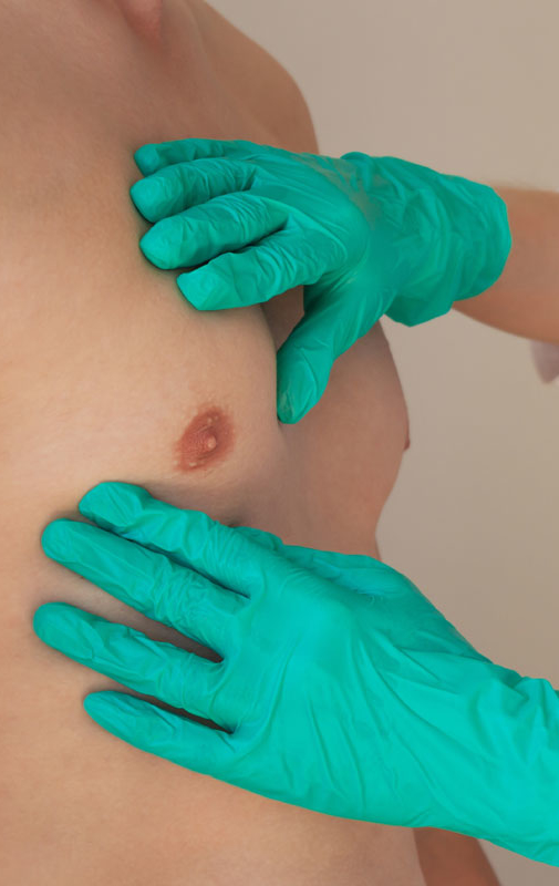 Northwood Hospital - Male Breast Reduction Procedure Overview