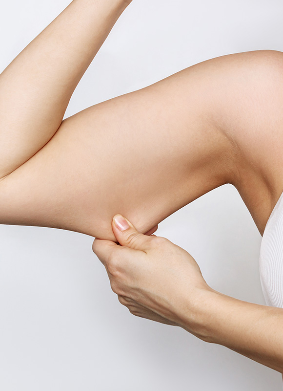 Northwood Hospital - Overhanging skin arms