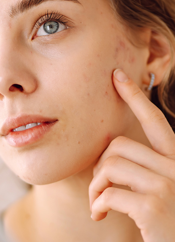 Northwood Hospital - Poor complexion