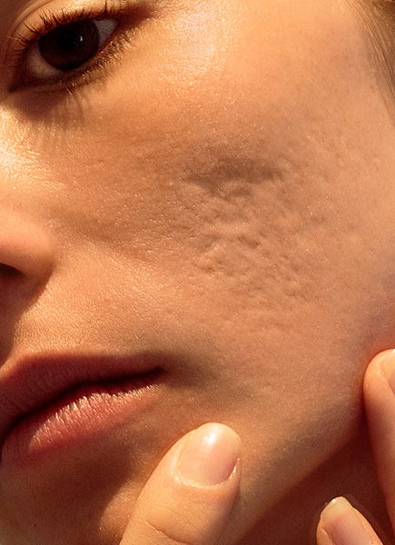 Northwood Hospital - Poor scars