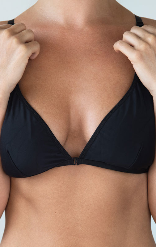 Northwood Hospital - Revision Breast Surgery Procedure Overview