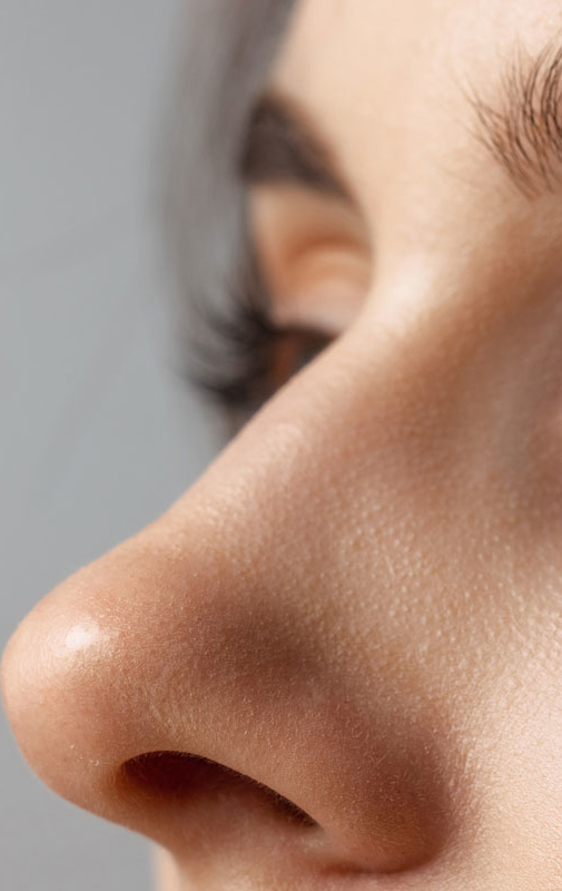 Northwood Hospital - Rhinoplasty Procedure Overview
