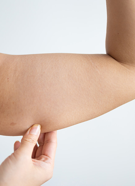 Northwood Hospital - Excess fat