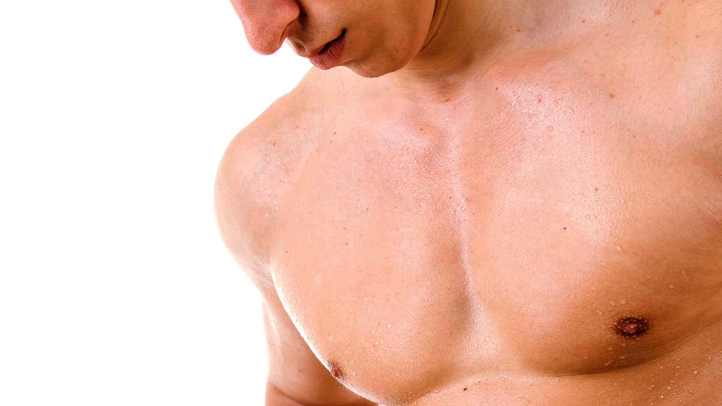 Northwood Hospital - Male Breast Reduction